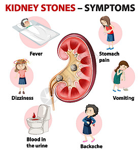 呕吐病人肾结石症状卡通风格 infographi呕吐药品头晕教育卡通片指示牌发烧弱点插图血尿插画