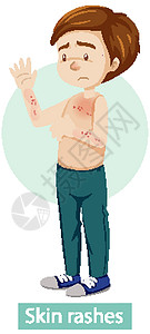赤膊上阵具有皮疹症状的卡通人物男人绘画痛苦卡通片疼痛保健学习艺术男性海报插画