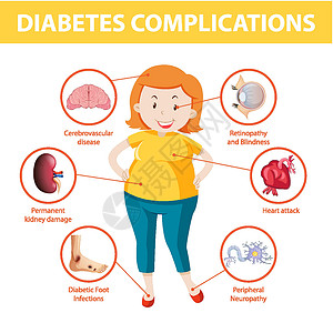糖尿病性视网膜病变糖尿病并发症信息图表重量绘画外设卡通片疾病指示牌插图学习疼痛弱点插画