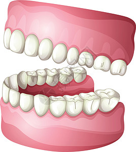 假记牙齿搪瓷假牙绘画下颌弓组织牙科器官牙龈假肢背景图片