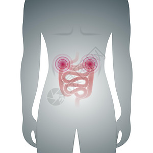 补气益血男性剪影与病态肠道医学载体它制作图案腹胀消化癌症腹泻胀气身体男人器官息肉便秘插画