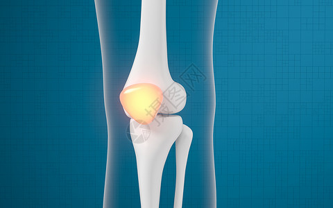 腿骨和膝盖损伤 3D感应骨科治疗蓝色手术外科药品软骨胫骨疼痛疾病背景