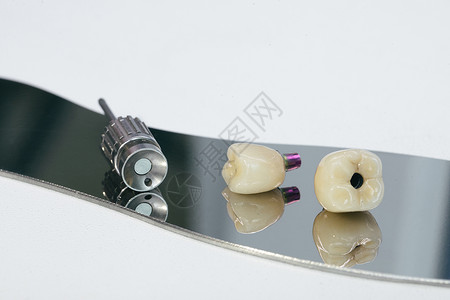 单石螺丝保留了植入的冠 一个螺丝和一个手动钥匙 用来与皇冠乱搞 掌上电脑制品工具解剖学陶瓷假牙矫正塑料植入物身体药品背景