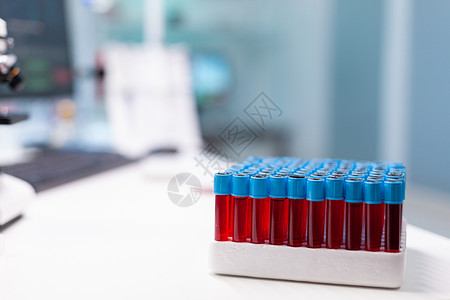 在药物检验期间 有血样的医药卫生真空剂放在桌上 药检期间背景