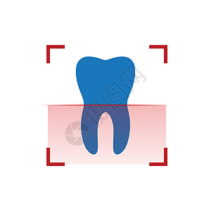 牙齿X光人类牙齿扫描 红色扫描仪或 x 射线 种植牙 治疗扫描概念 在白色背景上隔离的矢量图插画
