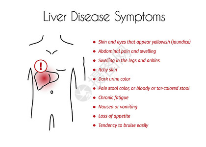 疼痛图年轻马的矢量肝病症状信息图设计图片