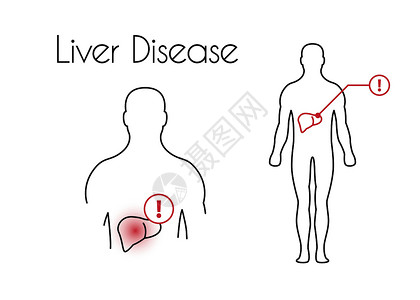 年轻男性病患腹部疼痛年轻马的矢量肝病线性图标插画