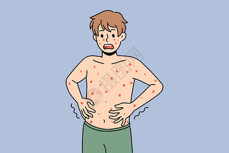 风疹发红不健康的人有红点患有疾病插画