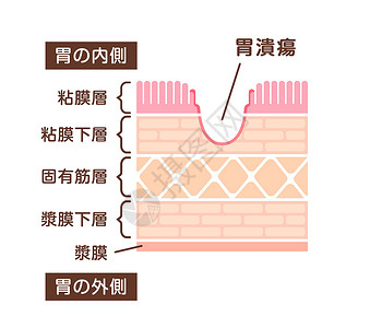 浆膜诊断风险高清图片