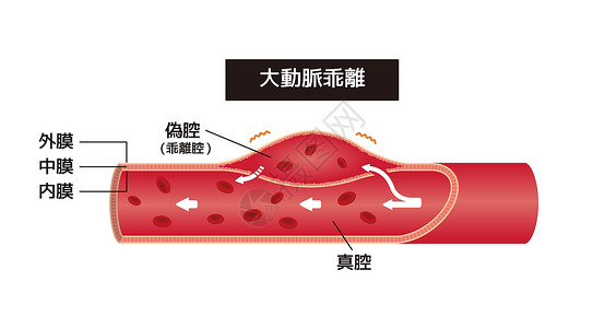 造影动解剖矢量说明(日语)插画