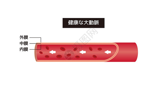 血管外科正常动脉的植被说明(日语)设计图片