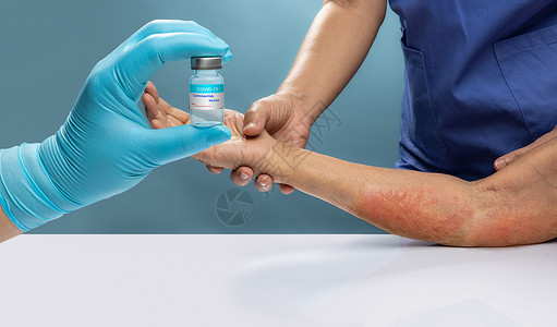 接种疫苗后 老年人有19种过敏症状药品过敏反应低血压皮疹肌肉副作用卫生保健发烧医疗背景图片
