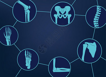 弯头排水整形和骨骼符号 人类关节和骨头组装 矢量插图脊柱图表肩膀疼痛信息x光诊断医学医院插画