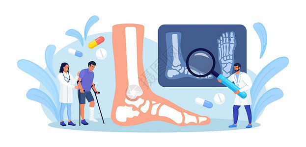 低头看脚腿部骨折的人咨询创伤外科医生 医生在看 X 光片 医疗保健 护士用腿上的石膏安慰拄着拐杖的受伤病人插画
