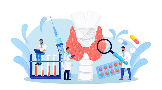 科学补碘内分泌学家诊断和治疗人类甲状腺 医生对激素进行血液检查 甲状腺功能减退症 甲状腺功能亢进症的概念 甲状腺检查 健康医疗癌症结节生插画