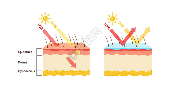 渗透皮肤UV防护 日光屏润滑剂保护人类皮肤免受UVA UVB射线的辐射晒斑健康表皮插图阳光癌症皮肤科烧伤太阳损害插画