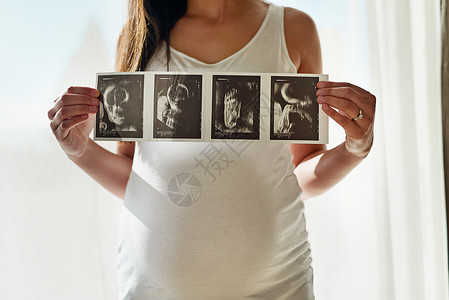 婴儿的第一张肖像 照片中一位身份不明的孕妇在家中的窗前举着一系列超声波照片背景图片