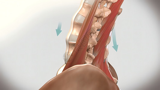 慢性低速后退疼痛 下背痛按摩痛苦风湿病伤害疾病工人扭伤肌肉脊柱骨科背景图片
