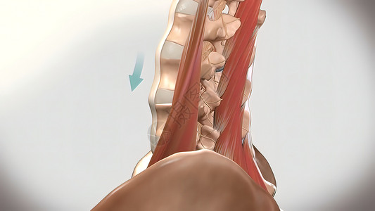 慢性低速后退疼痛 下背痛躯干紧张痛苦疾病按摩伤害女士肌肉风湿病脊柱背景图片