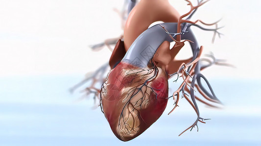 衰竭急性冠状腺综合征3d胸部梗塞伤害咖啡心脏病药片血压起搏器情况攻击背景