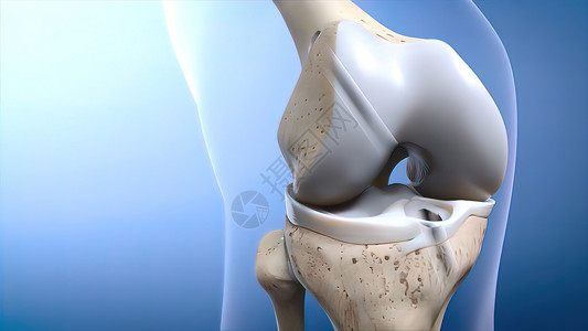 创伤或眼泪ACL关节控制痛苦症状老化压力手术解剖学股骨列表背景图片