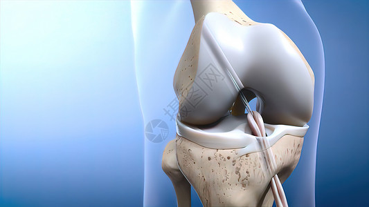 访问控制创伤或眼泪ACL护膝压力膝盖胫骨软骨解剖学药品股骨控制伤害背景