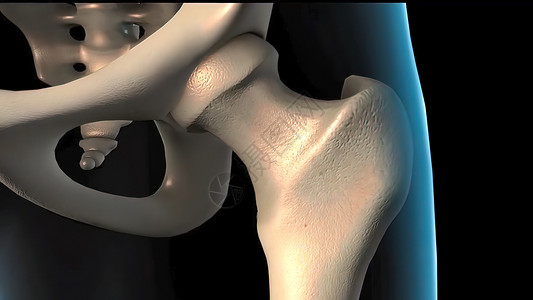 将人体骨质骨质疏松症海绵组织从正常组织发展成病人组织僵化解剖学平移衬垫骨细胞骨科康复插图股骨修理背景图片