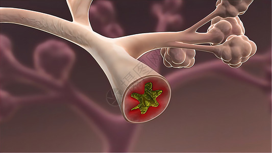 肌纤维血流量支气管肺段高清图片