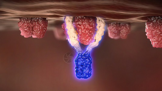 防癌细胞的抗体受体 防止癌症细胞淋巴医疗疾病倍率胰岛素计算机科学免疫学机制人体背景图片