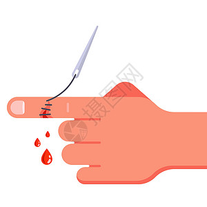 手伤把手臂上的伤口缝上 血从切伤的手指里流出缝合医院接缝治疗皮肤疼痛援助医生瘢痕卫生插画