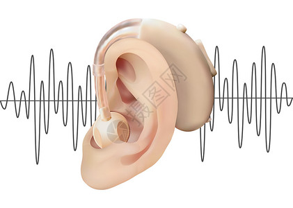 在耳后的数字式助听器 在声波图的背景上 耳鼻喉科听力损失的治疗和修复 现实的矢量图 医药卫生听觉身体器官插图调节器皮肤衬垫方法假插画