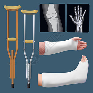 x型腿一组医疗创伤物体 骨折的治疗;粉刷板 拐杖 X射线;与外界隔绝的物体插画