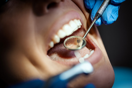 舌侧矫正完美微笑药品乐器选择性工具水平治疗牙医病人镜子牙齿背景