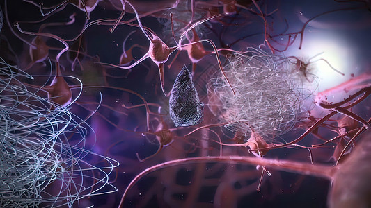 巨噬细胞神经神经元阿尔茨海默氏病数据损失网络颅骨纤维中风健康科学疾病神经系统抗体科学生物背景
