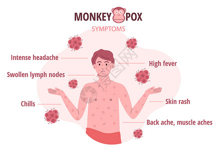 皮肤危险人类病毒症状分布图 向人们介绍传染病的矢量插图在2001年9月1日至2002年6月30日期间痘痘药品图表预防治疗诊断淋巴科学身体插画