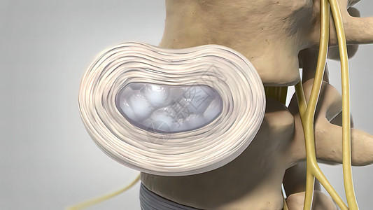 补间动画素材3d 医疗治疗疾病器官椎间状况骨刺磁盘椎骨骨科脊髓骨赘骨头背景