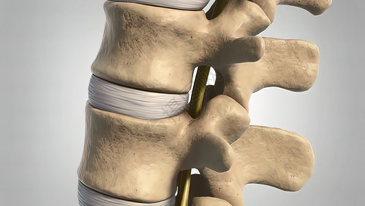 小骨头3d 医疗治疗疾病骨刺状况骨赘学家磁盘腰椎障碍骨头脊髓神经背景