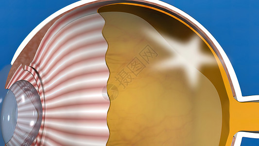 糖尿病眼视网膜组织3D医疗眼解剖镜片卫生眼球模拟药品验光医生角膜状况眼科背景