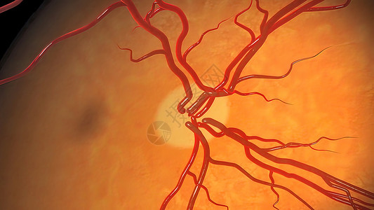 视网膜中央静脉Glaucoma是一种眼睛状况 它损害光神经 对良好的视力至关重要肌肉科学保健手表角膜脉络膜教育药品静脉视网膜背景