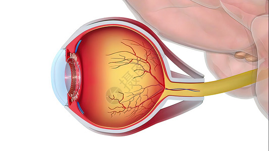 神经肌肉再教育Glaucoma是一种眼睛状况 它损害光神经 对良好的视力至关重要眼科卫生镜片手表瞳孔静脉青光眼解剖学乐器光学背景