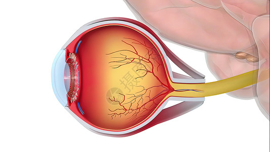 神经肌肉再教育Glaucoma是一种眼睛状况 它损害光神经 对良好的视力至关重要解剖学镜片鸢尾花眼科静脉青光眼结膜玻璃科学巩膜背景