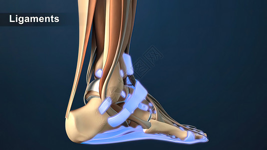 裂脚亚目脚中断裂的叶子或天登药品韧带疾病治疗鞋底痛苦扭伤解剖学成人症状背景
