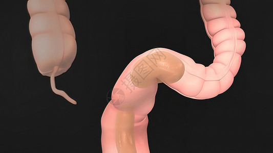 人类消化系统解剖毒素同化便秘食管排毒肠道科学胃肠道过程药品背景图片