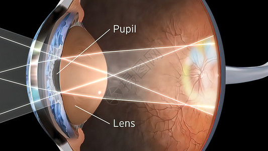 右侧脉络膜人眼视觉结构手术神经科学眼球脉络膜肌肉外科图表瞳孔视网膜背景