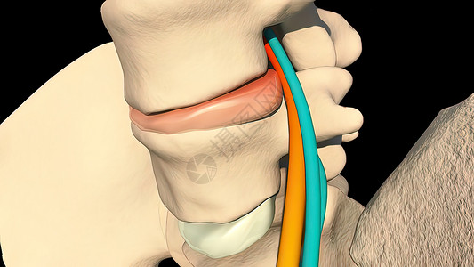 神经丛散热骨干高清图片