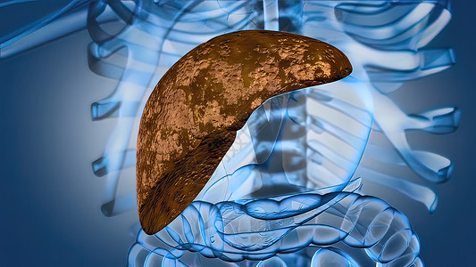 胃肠疾病肝病的进化 肝衰竭解剖学外科科学攻击身体脂肪酸细胞手术生物学肝硬化背景