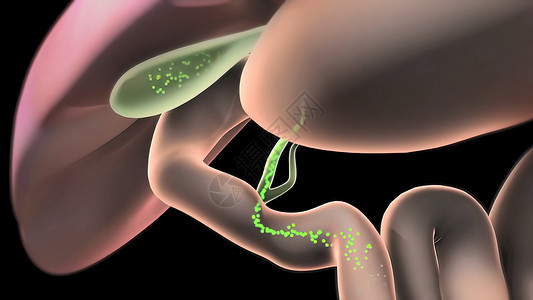 活性 潘克里亚和盖球形条件治疗肝硬化男性攻击痛苦脂肪酸图表黄疸癌症疼痛背景图片