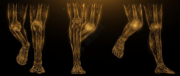 x型腿人腿解剖的多边形矢量图解 深色背景上的低聚艺术下肢 腿部解剖艺术的血肉和骨骼 医疗横幅或模板插画