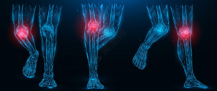 聚势赋能人类腿部的多角矢量说明 膝关节概念的发炎性疾病 深蓝色背景下肢低聚能艺术设计图片