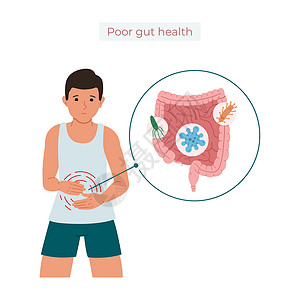 做胃镜以矢量说明一个患有腹部疼痛 微生物中毒或腹泻概念的男子因微生物而导致的肠胃痛插画